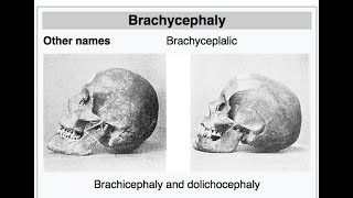 DolichocephalicBasics of AnatomyAnthropology Optional [upl. by Ragse]