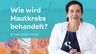 Wie wird Hautkrebs behandelt [upl. by Nehemiah]