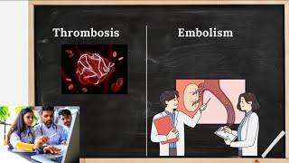 Thrombus VS Embolus EXPLAINED  Differences Between Clot and Embolus  Thrombosis vs Embolism [upl. by Enihpad]