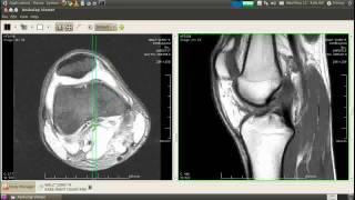 DICOM on Linux Ubuntu [upl. by Ayortal]