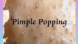 Pimple amp Blackheads Popping  37 [upl. by Otsirc435]