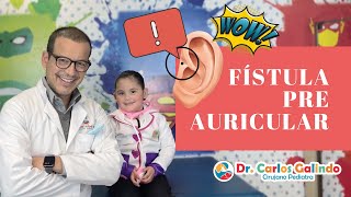 Ayuda mi hijo tiene infección en el oído Fístula Preauricular Hoyelo preauricular infectado [upl. by Allain]