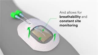 3M™ Tegaderm™ CHG Dressing Science Video [upl. by Cardon]