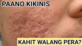 BUROG NA MUKHA PAANO KIKINIS KAHIT WALANG PERA PANG LASER [upl. by Kimberlyn]