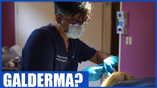 Galderma  Why physicans choose Galderma Products [upl. by Vidal339]