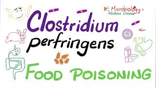 Clostridium perfringens Food 🥘 Poisoning 🤮  Microbiology 🧫 amp Infectious Diseases [upl. by Robbins17]