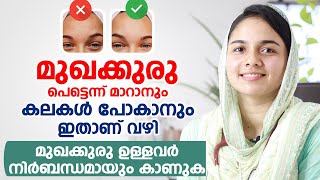 മുഖക്കുരു Acne Pimples പെട്ടെന്ന് മാറാനും കലകൾ പോകാനും ഇതാണ് വഴി [upl. by Scarrow]