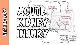 Approach to renal failure [upl. by Tito]