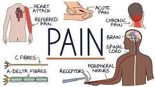 Understanding The Causes of Pain and Pain Management [upl. by Gisele24]