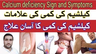 Calcium Deficiency Sign amp Symptoms and Treatment in UrduHindi  Best natural sources of Calcium [upl. by Melleta]