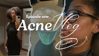 EPISODE 1 ACNE VLOG ACCUTANE  skincare [upl. by Soph895]