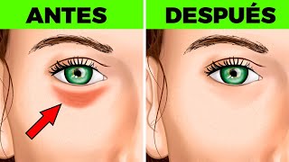 👓18 REMEDIOS FÁCILES PARA ELIMINAR LAS BOLSAS EN LOS OJOS [upl. by Kling]