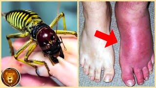 Top 10 der schmerzhaftesten Insektenstiche der Welt [upl. by Verras]