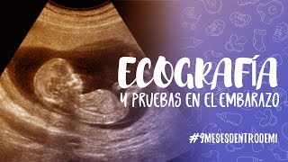 Ecografía semana 12 y pruebas para detectar anomalías cromosómicas [upl. by Eisak]