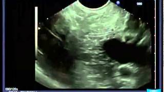 Longitudinal EUS Anatomical Guiding Structures in the Upper Abdomen Cranial  Right [upl. by Bourgeois]