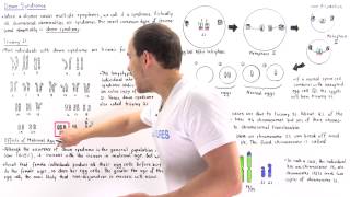 Down Syndrome Trisomy 21 and Translocation [upl. by Lenej573]