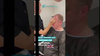 Hair transplant process of our dear patient Lea Barker from United Kingdom🇬🇧 [upl. by Rolan]