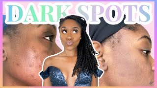 SKIN  How To Get Rid of Dark Spots Hyperpigmentation Fast Updated Routine No Click Bait [upl. by Oisor]