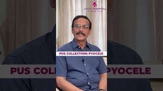 Problems of HydroceleHydrocele குறித்த பிரச்சினைகள்testiclepain healthtips menshealth mustwatch [upl. by Laeria]