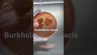 Burkholderia cepacia trên thạch MC BurkholderiaCepacia ViKhuanNguyHiem MacConkey YHoc SucKhoe [upl. by Nanette]