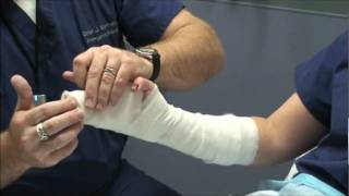 Splint Workshop 3  Ulnar Gutter Splint [upl. by Buiron318]