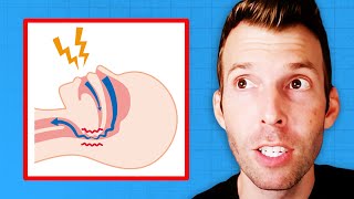 How to Fix Snoring amp Sleep Apnea Once and for All  Dr Kevin Stock [upl. by Deanna940]