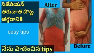 After cesarean belly reducing  how to burn belly fat in telugu  Fat reduce tips [upl. by Llerej]