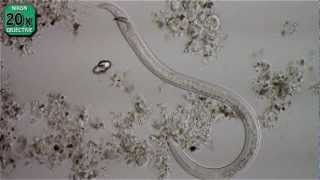 Nematode  Necator Americanus [upl. by Festa39]