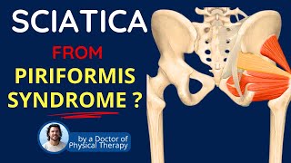 Piriformis Syndrome Sciatica Symptoms amp Back Pain [upl. by Iemaj807]