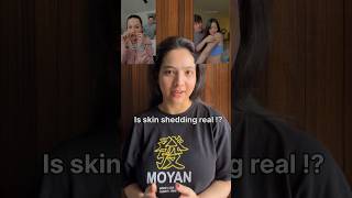 Is skin shedding real shorts skincare ytshortsindia viral trending [upl. by Aidua345]