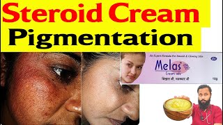 Steroid cream Side effect on face  Pigmentation कैसे ठीक करें ॰॰ Dr Prateek chauhan [upl. by Hinckley]