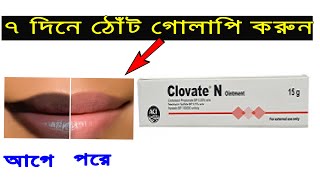 Clovate N Ointment Review Bangla । Benefits Uses Price Side Effects  ToTo Company BD [upl. by Shoifet]