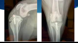 Cruciate LIgament Rupture in Immature Dogs [upl. by Estell]