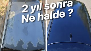 Güneş yanığı onarımı sonrası son durum  Sohbet Havasında [upl. by Morra]