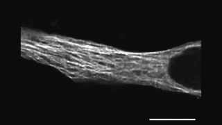 A novel isoform of MAP4 organises the paraxial microtubule array required for muscle cell [upl. by Hedberg]