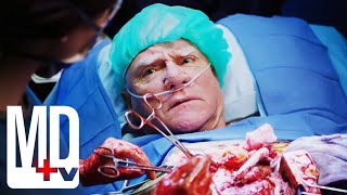 Eminent Doctor Requests Conscious Heart Surgery Guest Star Malcolm McDowell  Chicago Med  MD TV [upl. by Adnilec]