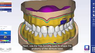 Cómo diseñar dentaduras postizas completas en Planmeca PlanCAD® Premium [upl. by Urquhart]