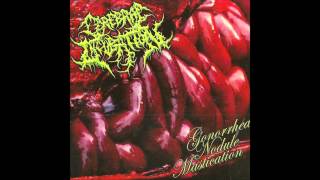 Cerebral Incubation  Gonhorrea Nodule Mastication Full Album 2012 HD [upl. by Barbour]