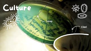 Urine Culture Test  Step by step guide 🌸🔬 Medical Laboratory  Microbiology  Procedure amp Results [upl. by Norrek]