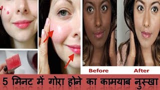 गोरा होने का 100 कामयाब घरेलू नुस्खा और तरीका  Skin Whitening Home Remedy  Gora Hone Ke Nuskhe [upl. by Ahidam]