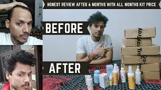 Traya Hair Review After 6 Months  Traya Honest Review  Traya Hair Result Review  Traya Ki Sachai [upl. by Persson]