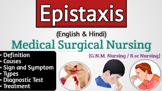 Epistaxis ent lecture  Epistaxis in hindi  Nosebleed [upl. by Enerual]