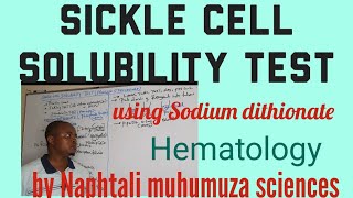 Hematology Sickle cell Solubility Test  Sodium dithionate [upl. by Arnie]