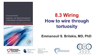 83 Manual of PCI  Wiring through tortuosity [upl. by Gurango]