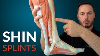 Understanding SHIN SPLINTS and how to fix it [upl. by Paza]