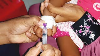 Meropenem injection Cannula  Child  তে Push 24 Ep 39 By Injection Tv [upl. by Yrad]