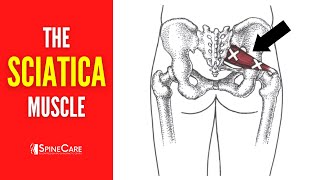 The Sciatica Muscle How to Release It for INSTANT RELIEF [upl. by Klinger266]