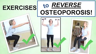 Reversing Osteoporosis Naturally Through Exercise – Best Exercises to Build Bone [upl. by Lanrev]