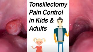 Tonsillectomy Pain Control in Kids and Adults [upl. by Giff]