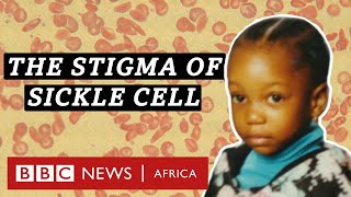 Sickle cell I didnt know I had the disease  BBC Africa [upl. by Sukul]